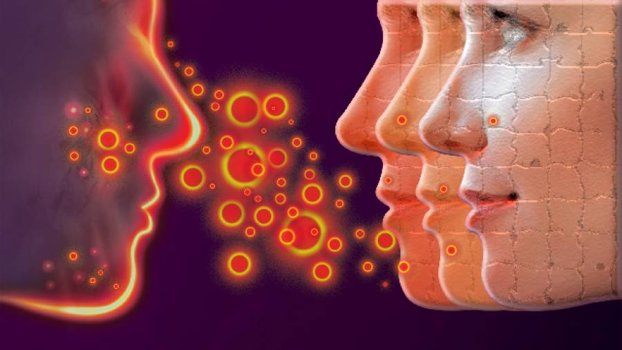 Rosacea - Wenn mit 30 die Pickel wiederkommen